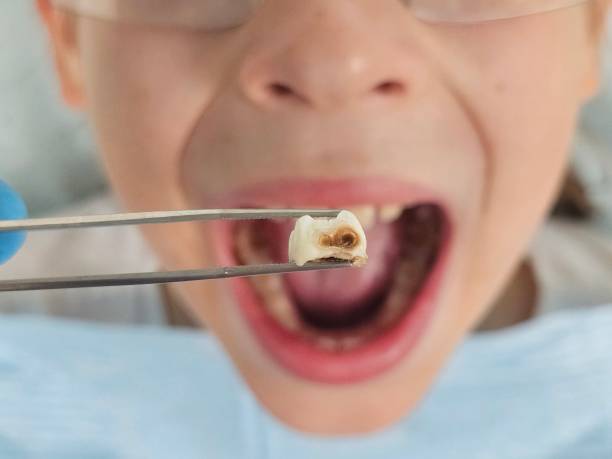Best Tooth Infection Emergency Dentist  in Blossburg, PA